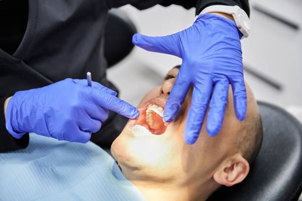 Best Emergency TMJ Treatment in Riverdale Park, CA