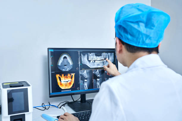 Best Emergency Wisdom Teeth Removal in Riverdale Park, CA