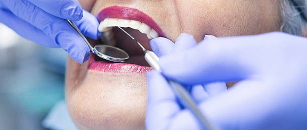 Best Emergency Treatment for Dental Infections or Abscesses in Riverdale Park, CA